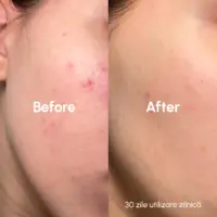 Prosoape faciale Glow XL 50 - imagine 5